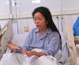 Ảnh minh họa