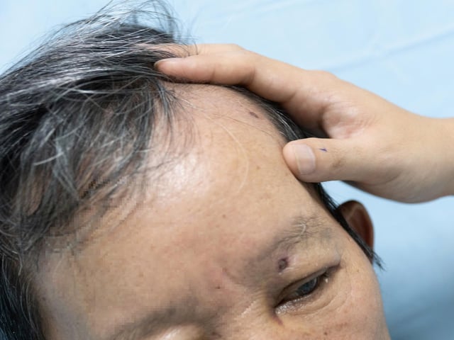 Ảnh bìa bài viết 1000331