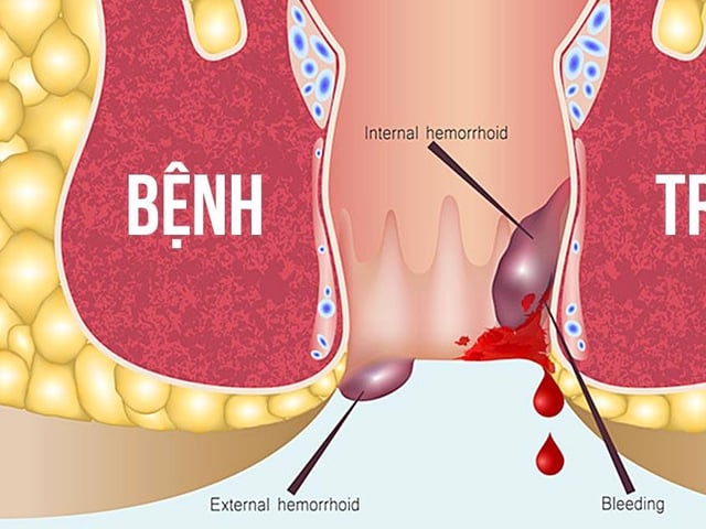 Ảnh bìa bài viết 1000725
