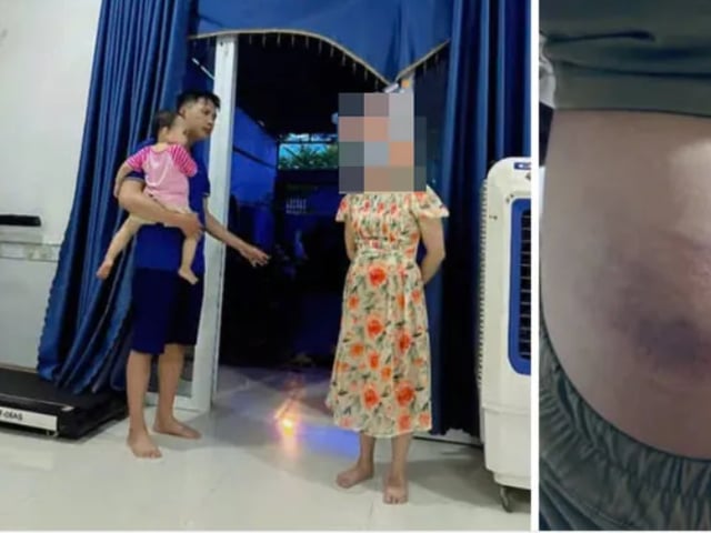 Ảnh bìa bài viết 1000823