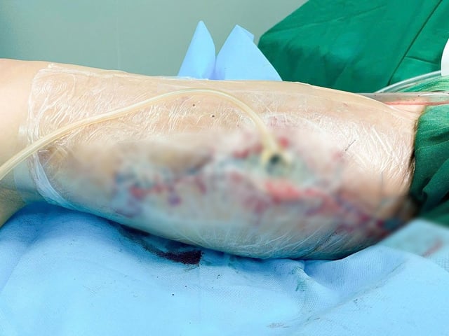 Ảnh bìa bài viết 1001032