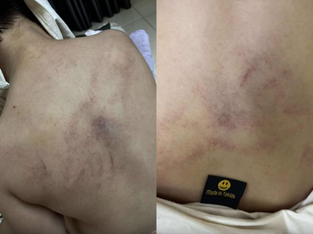 Ảnh bìa bài viết 1001541