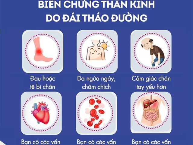 Ảnh bìa bài viết 1001614