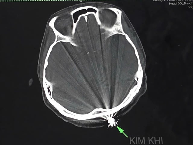 Ảnh bìa bài viết 1004037