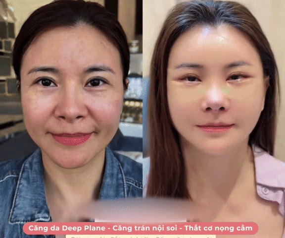 Ảnh bìa bài viết 1007448