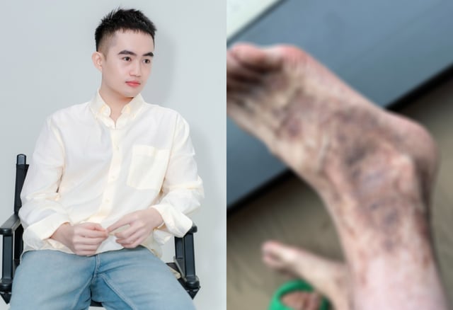 Ảnh bìa bài viết 1008210
