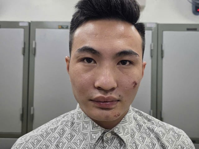 Ảnh bìa bài viết 1008436