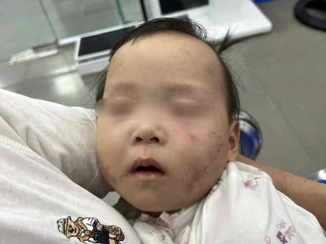 Ảnh bìa bài viết 1009397