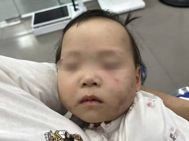 Ảnh bìa bài viết 1009423