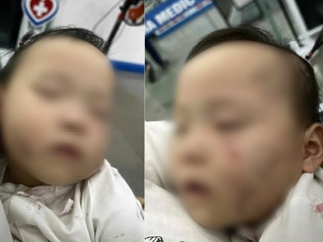 Ảnh bìa bài viết 1009621