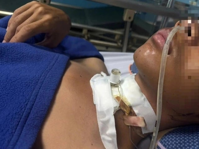 Ảnh bìa bài viết 1012292
