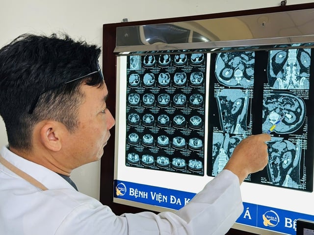 Ảnh bìa bài viết 1012444