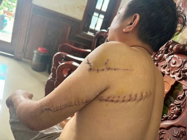 Ảnh bìa bài viết 1013558