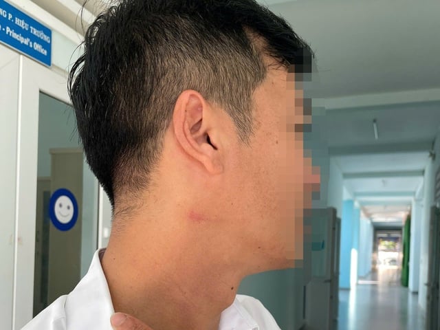 Ảnh bìa bài viết 1014624