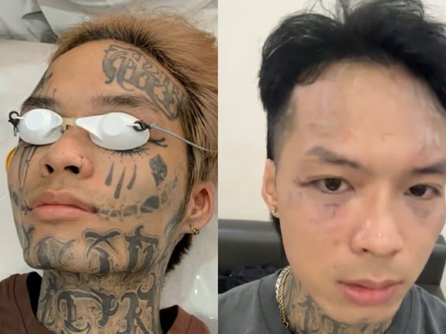 Ảnh bìa bài viết 1015398