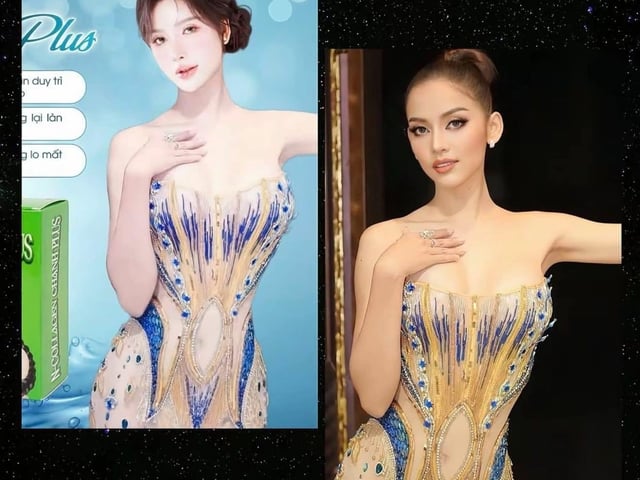 Ảnh bìa bài viết 1015677