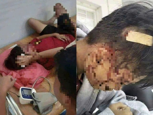 Ảnh bìa bài viết 1016813