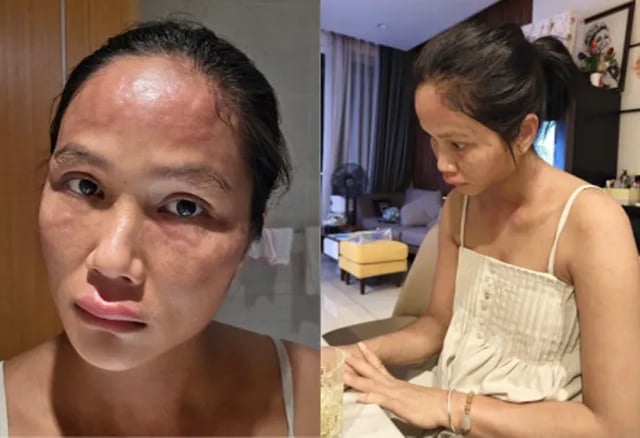 Ảnh bìa bài viết 1017153