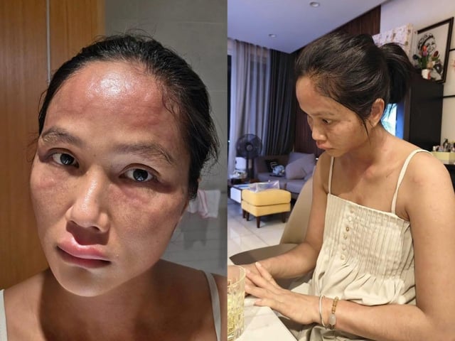 Ảnh bìa bài viết 1017654