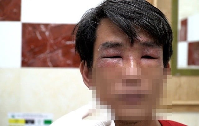 Ảnh bìa bài viết 1018859