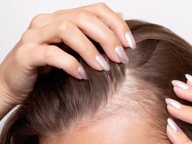 Đọc nhanh bài viết #1019904