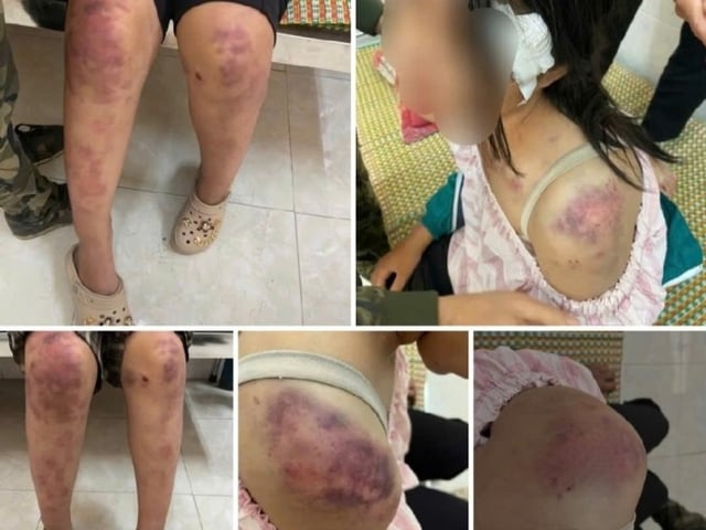 Ảnh bìa bài viết 1020481