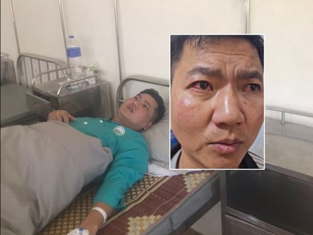 Ảnh bìa bài viết 1020670