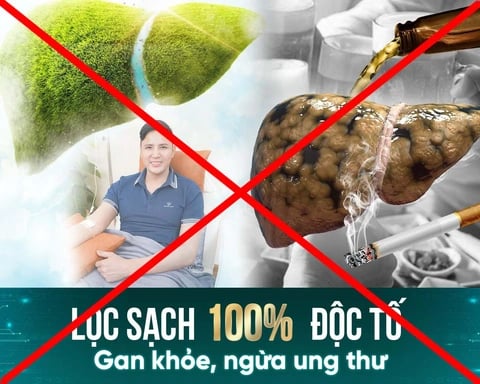 Ảnh bìa bài viết 1020673