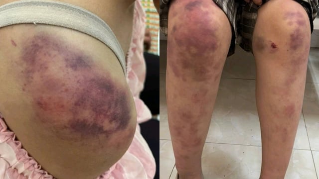 Ảnh bìa bài viết 1021046