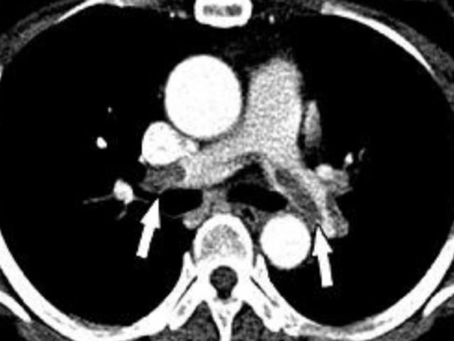 Ảnh bìa bài viết 1022141