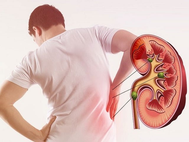 Ảnh bìa bài viết 1022376