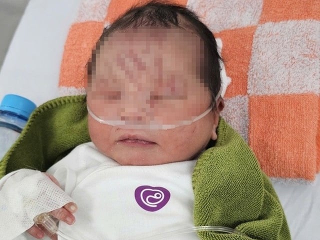 Ảnh bìa bài viết 1022493