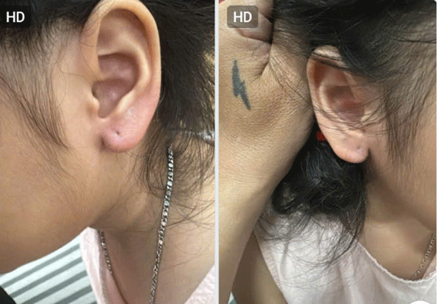 Ảnh bìa bài viết 1022540