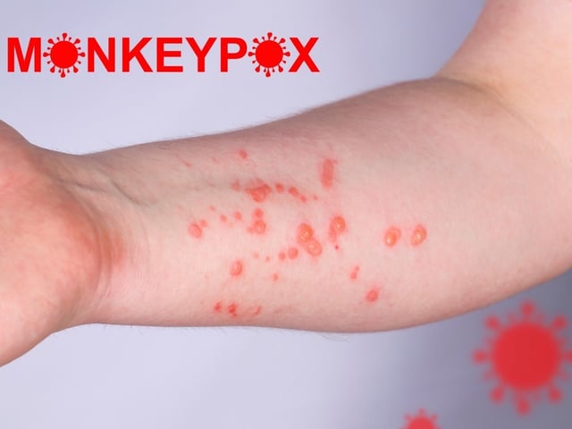 Đọc nhanh bài viết #1022585