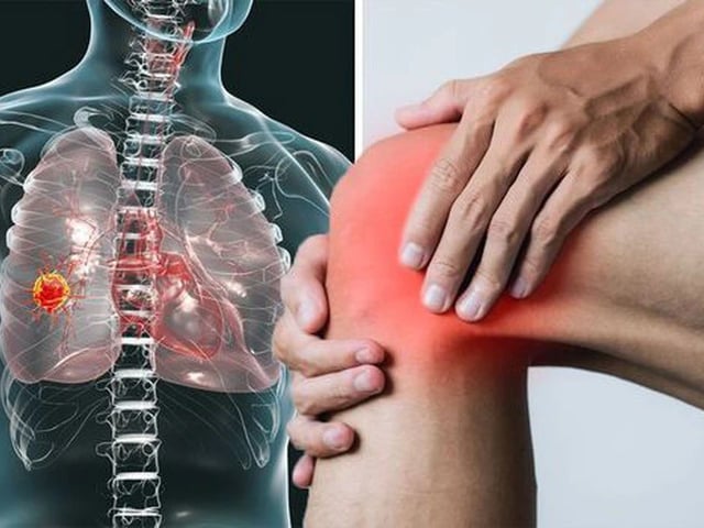 Ảnh bìa bài viết 1022652