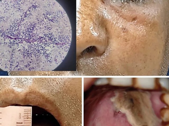 Đọc nhanh bài viết #1028292