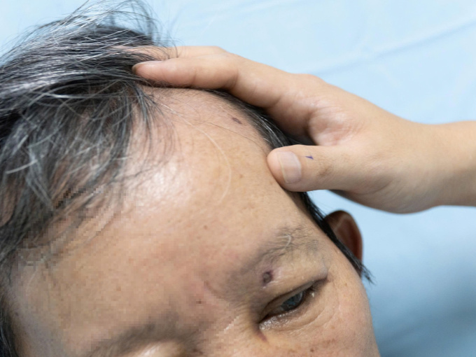 Docnhanh bài viết #1000331