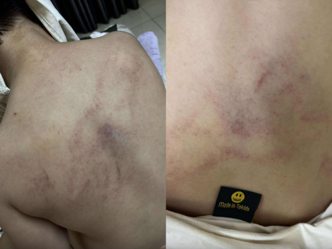 Docnhanh bài viết #1001263
