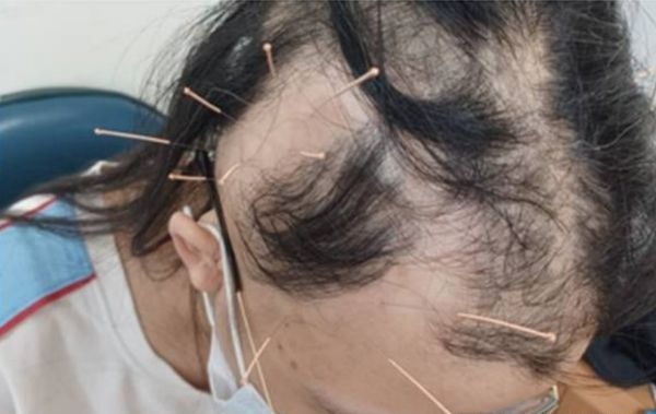 Docnhanh bài viết #1001740